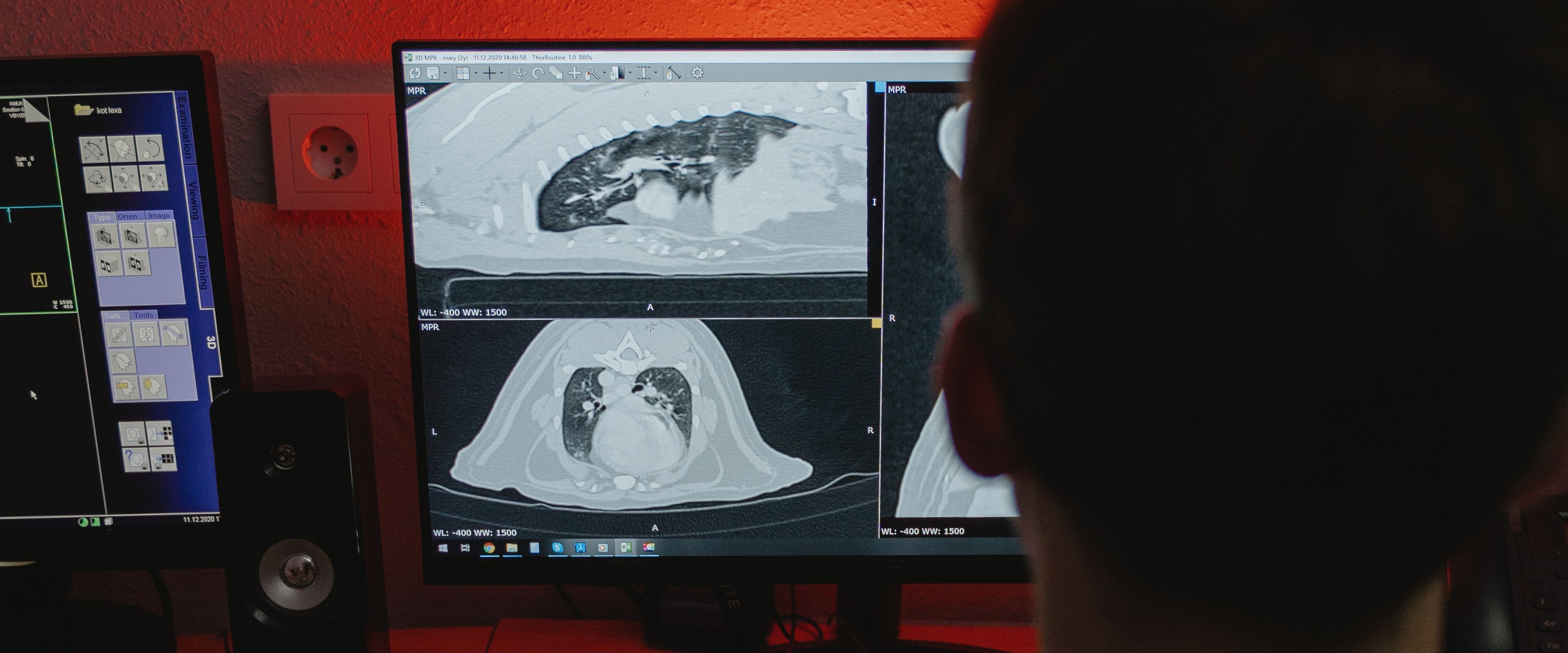 Radiologist reviewing CT scans on screen