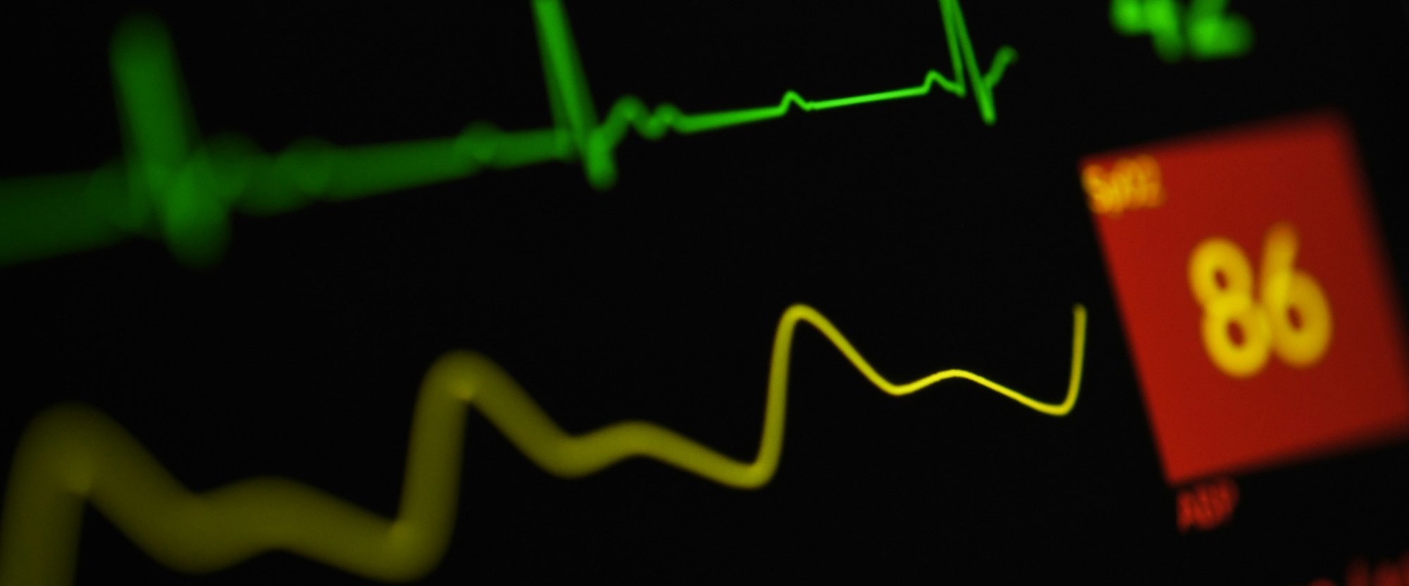 Heart health metrics